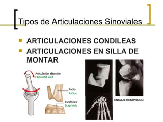 Tipos de Articulaciones Sinoviales

   ARTICULACIONES CONDILEAS
   ARTICULACIONES EN SILLA DE
    MONTAR
 