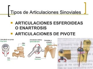 Tipos de Articulaciones Sinoviales

   ARTICULACIONES ESFEROIDEAS
    O ENARTROSIS
   ARTICULACIONES DE PIVOTE
 