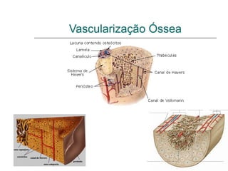 Vascularização Óssea
 