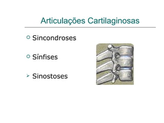 Articulações Cartilaginosas
   Sincondroses

   Sínfises

   Sinostoses
 