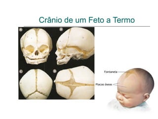 Crânio de um Feto a Termo
 