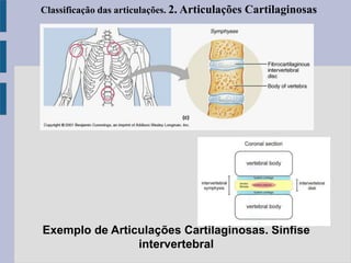 Exemplo de Articulações Cartilaginosas. Sínfise
intervertebral
Classificação das articulações. 2. Articulações Cartilaginosas
 