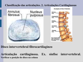 Articulação cartilaginosa. Ex. sínfise intervertebral.
Verificar a posição do disco na coluna
Classificação das articulações. 2. Articulações Cartilaginosas
Disco intervertebral fibrocartilagineo
 