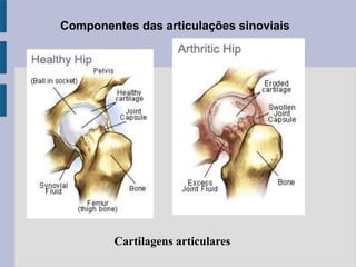 Componentes das articulações sinoviais
Cartilagens articulares
 