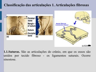 1.1.Suturas. São as articulações do crânio, em que os ossos são
unidos por tecido fibroso - os ligamentos suturais. Ocorre
sinostose.
Classificação das articulações 1. Articulações fibrosas
 