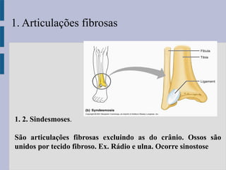 1. 2. Sindesmoses.
São articulações fibrosas excluindo as do crânio. Ossos são
unidos por tecido fibroso. Ex. Rádio e ulna. Ocorre sinostose
1. Articulações fibrosas
 