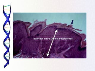 Interface entre Dermis y Epidermis
 