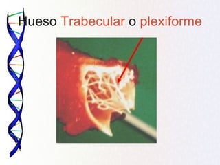 Hueso Trabecular o plexiforme
 