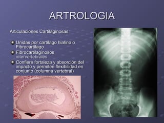 AARRTTRROOLLOOGGIIAA 
AArrttiiccuullaacciioonneess CCaarrttiillaaggiinnoossaass 
UUnniiddaass ppoorr ccaarrttííllaaggoo hhiiaalliinnoo oo 
FFiibbrrooccaarrttííllaaggoo 
FFiibbrrooccaarrttiillaaggiinnoossooss 
iinntteerrvveerrtteebbrraalleess 
CCoonnffiieerree ffoorrttaalleezzaa yy aabbssoorrcciióónn ddeell 
iimmppaaccttoo yy ppeerrmmiitteenn fflleexxiibbiilliiddaadd eenn 
ccoonnjjuunnttoo (ccoolluummnnaa vveerrtteebbrraall) 
 