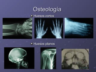 OOsstteeoollooggííaa 
HHuueessooss ccoorrttooss 
HHuueessooss ppllaannooss 
 