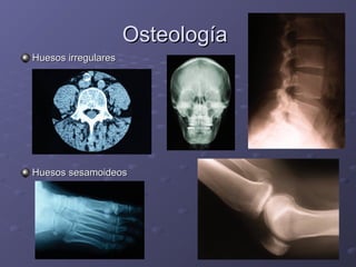 OOsstteeoollooggííaa 
HHuueessooss iirrrreegguullaarreess 
HHuueessooss sseessaammooiiddeeooss 
 