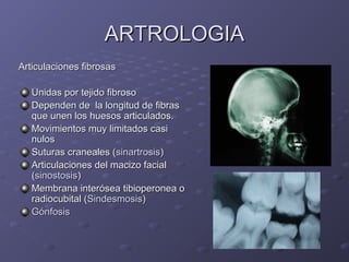 AARRTTRROOLLOOGGIIAA 
AArrttiiccuullaacciioonneess ffiibbrroossaass 
UUnniiddaass ppoorr tteejjiiddoo ffiibbrroossoo 
DDeeppeennddeenn ddee llaa lloonnggiittuudd ddee ffiibbrraass 
qquuee uunneenn llooss hhuueessooss aarrttiiccuullaaddooss.. 
MMoovviimmiieennttooss mmuuyy lliimmiittaaddooss ccaassii 
nnuullooss 
SSuuttuurraass ccrraanneeaalleess ((ssiinnaarrttrroossiiss)) 
AArrttiiccuullaacciioonneess ddeell mmaacciizzoo ffaacciiaall 
((ssiinnoossttoossiiss)) 
MMeemmbbrraannaa iinntteerróósseeaa ttiibbiiooppeerroonneeaa oo 
rraaddiiooccuubbiittaall ((SSiinnddeessmmoossiiss)) 
GGóónnffoossiiss 
 