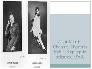 Jean-Martin
Charcot. Hysteria
induced epileptic
 seizures. 1878.
 