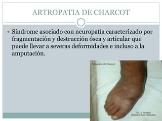ARTROPATIA DE CHARCOT

 Síndrome asociado con neuropatía caracterizado por
 fragmentación y destrucción ósea y articular que
 puede llevar a severas deformidades e incluso a la
 amputación.
 
