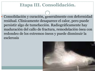 Etapa III. Consolidación.

 Consolidación y curación, generalmente con deformidad
 residual. Clínicamente desaparece el calor, pero puede
 persistir algo de tumefacción. Radiográficamente hay
 maduración del callo de fractura, remodelación ósea con
 redondeo de los extremos óseos y puede disminuir la
 esclerosis
 