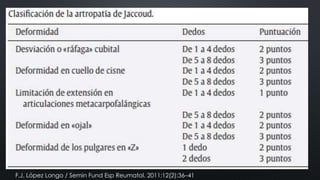 F.J. López Longo / Semin Fund Esp Reumatol. 2011;12(2):36–41

 