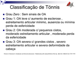 Classificação de Tönnis
 Grau Zero : Sem sinais de OA
 Grau 1: OA leve c/ aumento de esclerose ,
estreitamento articular mínimo, ausencia ou mínima
perda de esfericidade
 Grau 2: OA moderada c/ pequenos cistos,
moderado estreitamento articular , moderada perda
da esfericidade
 Grau 3: OA severa c/ grandes cistos , severo
estreitamento articular e severa deformidade da
cabeça
Tönnis D, Heinecke A: Acetabular and femoral anteversion : Relationship with osteoarthhritis of the hip JBJS Am 1999;81(12):1747-1770
 