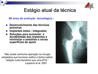 Estágio atual da técnica
60 anos de evolução tecnológica :
 Desenvolvimento das técnicas
pioneiras
 Implantes ósteo - integrados
 Soluções para aumentar a
durabilidade dos implantes e
minimizar a osteólise e novas
superfícies de apoio
“Não existe nenhuma operação na cirurgia
ortopédica que funcione melhor e tenha melhor
relação custo-benefício que uma ATQ.”
Laupacis et al. 2001
 