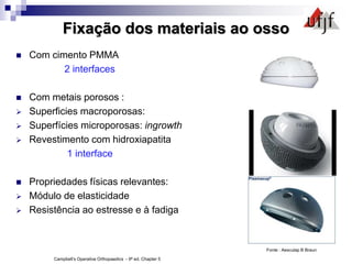 Fixação dos materiais ao osso
 Com cimento PMMA
2 interfaces
 Com metais porosos :
 Superficies macroporosas:
 Superfícies microporosas: ingrowth
 Revestimento com hidroxiapatita
1 interface
 Propriedades físicas relevantes:
 Módulo de elasticidade
 Resistência ao estresse e à fadiga
Fonte : Aesculap B Braun
Campbell’s Operative Orthopaedics - 9ª ed. Chapter 5
 