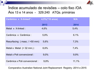 Índice acumulado de revisões – colo fixo /OA
Aos 13 e 14 anos - 329.240 ATQs. primárias
Comparativo Australian National Joint Replacement Registry -2014 e 2015
Cerâmica x X-linked* : 4,5%(*10 anos) N/A
2013 2014
Metal x X-linked : 4,6% 5,4%
Cerâmica x Cerâmica : 5,8% 6.1%
Resurfacing ( masc. / >50 mm): 5,6% 7,3%
Metal x Metal (< 32 mm.) : 6,6% 7,4%
Metal x Poli convencional : 9,0% 9,9%
Cerâmica x Poli convencional : 9,8% 11,1%
 