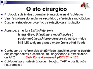 O ato cirúrgico
 Protocolos definidos : planejar é antecipar as dificuldades !
 Usar templates do implante escolhido ,referências radiológicas
 Buscar restabelecer o centro de rotação da articulação
 Acessos: anterior (Smith-Petersen)
lateral direto (Hardinge e modificações )
posterior(Gibson,Moore)c/reparo de partes moles
MIS/LIS :exigem grande experiência e habilidade
 Conhecer as referências anatômicas : posicionamento correto
dos componentes é essencial na longevidade e estabilidade
da ATQ Safe Zone -Lewinnek (40°/15° +- 10°)
 Cuidados para reduzir taxa de infecção, TVP* e ossificação
heterotópica
 