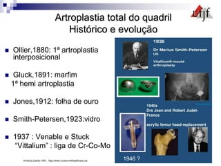 Artroplastia total do quadril
Histórico e evolução
 Ollier,1880: 1ª artroplastia
interposicional
 Gluck,1891: marfim
1ª hemi artroplastia
 Jones,1912: folha de ouro
 Smith-Petersen,1923:vidro
 1937 : Venable e Stuck
“Vittalium” : liga de Cr-Co-Mo
Amstutz;Clarke,1991; http://www.museumofhealthcare.ca/ 1946 ?
 
