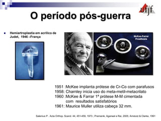 O período pós-guerra
 Hemiartroplastia em acrílico de
Judet, 1946 –França
Salenius P . Acta Orthop. Scand. 44, 451-459, 1973 ; Pramanik, Agarwal e Rai, 2005; Amstutz & Clarke, 1991
1951 :McKee implanta prótese de Cr-Co com parafusos
1958: Charnley inicia uso do meta-metil-metacrilato
1960 :McKee & Farrar 1ª prótese M-M cimentada
com resultados satisfatórios
1961: Maurice Muller utiliza cabeça 32 mm.
 