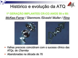 Histórico e evolução da ATQ
1ª GERAÇÃO IMPLANTES CR-CO ANOS 50 e 60:
McKee-Farrar / Stanmore /Sivash/ Muller / Ring
 Falhas precoces coincidiram com o sucesso clínico das
ATQs. de Charnley
 Abandonadas na década de 70
 