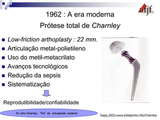 1962 : A era moderna
Prótese total de Charnley
 Low-friction arthoplasty : 22 mm.
 Articulação metal-polietileno
 Uso do metil-metacrilato
 Avanços tecnológicos
 Redução da sepsis
 Sistematização
Reprodutibilidade/confiabilidade
Rapp,2002;www.totaljoints.info/Charnley
Sir John Charnley : “Pai” da artroplastia moderna
 
