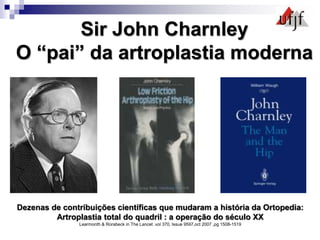 Sir John Charnley
O “pai” da artroplastia moderna
Dezenas de contribuições científicas que mudaram a história da Ortopedia:
Artroplastia total do quadril : a operação do século XX
Learmonth & Rorabeck in The Lancet .vol 370, Issue 9597,oct 2007 ,pg 1508-1519
 
