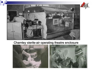 Charnley sterile-air operating theatre enclosure
 