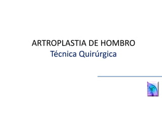 ARTROPLASTIA DE HOMBRO
Técnica Quirúrgica
 