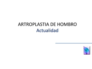 ARTROPLASTIA DE HOMBRO
Actualidad
 