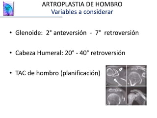 • Glenoide: 2° anteversión - 7° retroversión
• Cabeza Humeral: 20° - 40° retroversión
• TAC de hombro (planificación)
ARTROPLASTIA DE HOMBRO
Variables a considerar
 