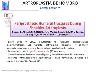 ARTROPLASTIA DE HOMBRO
Complicaciones
Periprosthetic Humeral Fractures During
Shoulder Arthroplasty
George S. Athwal, MD, FRCSC1, John W. Sperling, MD, MBA2, Damian
M. Rispoli, MD3 and Robert H. Cofield, MD
The Journal of Bone and Joint Surgery (American). 2009;91:594-603.
- Entre 1980 y 2002, ocurrieron 45 fracturas periprotésicas
intraoperatorias. 28 durante artroplastia primaria, 3 durante
hemiartroplastia primaria y 14 durante artroplastias de revisión.
- Se asocian a un alto grado de curación (17 semanas),
- Complicaciones: lesiones neurológicas y desplazamiento de la fractura.
- Factores intraoperatorios significativos: sexo femenino, cirugías de
revisión e implantes “press-fit”.
 