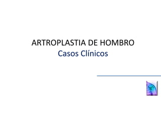 ARTROPLASTIA DE HOMBRO
Casos Clínicos
 