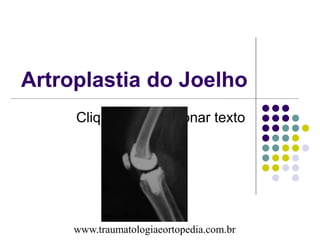 Clique para adicionar texto
Artroplastia do Joelho
www.traumatologiaeortopedia.com.br
 