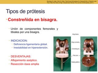 ARTROPLASTIA DE RODILLA. generalidades y principios | PPTX
