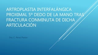 ARTROPLASTIA INTERFALÁNGICA
PROXIMAL 5º DEDO DE LA MANO TRAS
FRACTURA CONMINUTA DE DICHA
ARTICULACIÓN
Dra. C. Pérez Pastor
 