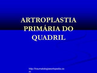 ARTROPLASTIA
PRIMÁRIA DO
QUADRIL
http://traumatologiaeortopedia.co
m
 