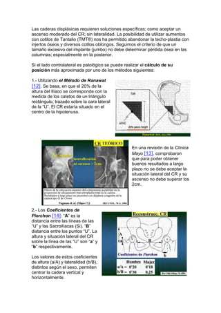 Las caderas displásicas requieren soluciones específicas; como aceptar un
ascenso moderado del CR; sin lateralidad. La posibilidad de utilizar aumentos
con cotilos de Tantalio (TMT®) nos ha permitido abandonar la techo-plastia con
injertos óseos y diversos cotilos oblongos. Seguimos el criterio de que un
tamaño excesivo del implante (jumbo) no debe determinar pérdida ósea en las
columnas; especialmente en la posterior.

Si el lado contralateral es patológico se puede realizar el cálculo de su
posición más aproximada por uno de los métodos siguientes:

1.- Utilizando el Método de Ranawat
[12]. Se basa, en que el 20% de la
altura del Ilíaco se corresponde con la
medida de los catetos de un triángulo
rectángulo, trazado sobre la cara lateral
de la “U”. El CR estaría situado en el
centro de la hipotenusa.




                                                   En una revisión de la Clínica
                                                   Mayo [13], comprobaron
                                                   que para poder obtener
                                                   buenos resultados a largo
                                                   plazo no se debe aceptar la
                                                   situación lateral del CR y su
                                                   ascenso no debe superar los
                                                   2cm.




2.- Los Coeficientes de
Pierchon [14]: “A” es la
distancia entre las líneas de las
“U” y las Sacroilíacas (Si). “B”
distancia entre los puntos “U”. La
altura y situación lateral del CR
sobre la línea de las “U” son “a” y
“b” respectivamente.

Los valores de estos coeficientes
de altura (a/A) y lateralidad (b/B),
distintos según el sexo, permiten
centrar la cadera vertical y
horizontalmente.
 