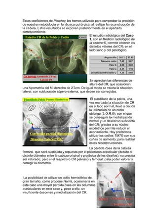 Estos coeficientes de Pierchon los hemos utilizado para comprobar la precisión
de nuestra metodologia en la técnica quirúrgica, al realizar la reconstrucción de
la cadera. Estos resultados se exponen posteriormente en el apartado
correspondiente.
                                               El estudio radiológico del Caso
                                               1, con el Medidor radiológico de
                                               la cadera ®, permite obtener los
                                               distintos valores del CR; en el
                                               lado sano y del patológico.




                                               Se aprecian las diferencias de
                                               altura del CR; que ocasionan
una hipometría del MI derecho de 2’3cm. De igual modo se valora la situación
lateral, con subluxación súpero-externa, que deben ser corregidas.

                                                 El plantillado de la pelvis, una
                                                vez marcada la situación de CR
                                                en el lado normal, llevó a decidir
                                                la utilización de un cotilo
                                                oblongo (L.O.R.®), con el que
                                                se conseguía la medialización
                                                normal y un descenso suficiente
                                                del CR; gracias a su núcleo
                                                excéntrico permite reducir el
                                                acortamiento. Hoy preferimos
                                                utilizar los cotilos TMT® con sus
                                                cuñas de aumento, para realizar
                                                estas reconstrucciones.
                                                 La pérdida ósea de la cabeza
femoral, que será sustituida y repuesta por el polietileno acetabular (debido al
distinto diámetro entre la cabeza original y protésica de los diseños), no precisa
ser valorado; pero sí el respectivo CR pelviano y femoral; para poder valorar y
corregir la dismetría.



 La posibilidad de utilizar un cotilo hemisférico de
gran tamaño, como propone Harris, ocasionaría en
este caso una mayor pérdida ósea en las columnas
acetabulares en este caso y, pese a ello, un
insuficiente descenso y medialización del CR.
 