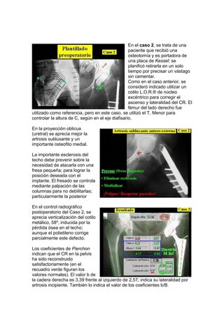 En el caso 2, se trata de una
                                                   paciente que recibió una
                                                   osteotomía y es portadora de
                                                   una placa de Kessel; se
                                                   planificó retirarla en un solo
                                                   tiempo por precisar un vástago
                                                   sin cementar.
                                                   Como en el caso anterior, se
                                                   consideró indicado utilizar un
                                                   cotilo L.O.R.® de núcleo
                                                   excéntrico para corregir el
                                                   ascenso y lateralidad del CR. El
                                                   fémur del lado derecho fue
utilizado como referencia, pero en este caso, se utilizó el T. Menor para
controlar la altura de C, según en el eje diafisario.

En la proyección oblicua
(uretral) se aprecia mejor la
artrosis subluxante y un
importante osteofito medial.

La importante esclerosis del
techo debe prevenir sobre la
necesidad de atacarla con una
fresa pequeña; para lograr la
posición deseada con el
implante. El fresado se controla
mediante palpación de las
columnas para no debilitarlas;
particularmente la posterior

En el control radiográfico
postoperatorio del Caso 2, se
aprecia verticalización del cotilo
metálico, 58º, inducida por la
pérdida ósea en el techo;
aunque el polietileno corrige
parcialmente este defecto.

Los coeficientes de Pierchon
indican que el CR en la pelvis
ha sido reconstruido
satisfactoriamente (en el
recuadro verde figuran los
valores normales). El valor b de
la cadera derecha es 3,39 frente al izquierdo de 2,57; indica su lateralidad por
artrosis incipiente. También lo indica el valor de los coeficientes b/B.
 