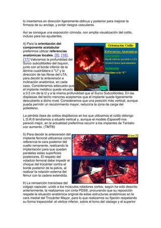 lo insertamos en dirección ligeramente oblicua y posterior para mejorar la
firmeza de su anclaje, y evitar riesgos vasculares.

Así se consigue una exposición cómoda, con amplia visualización del cotilo,
incluso para los ayudantes.

4) Para la orientación del
componente acetabular
preferimos utilizar referencias
anatómicas locales. [9], [16],
[17] Valoramos la profundidad del
Surco subcotiloideo del Isquion,
junto con el borde inferior de la
lámina cuadrilátera ó "U" y la
dirección de las fibras del LTA,
para decidir la anteversión e
inclinación anatómica, en cada
caso. Consideramos adecuado que
el implante metálico quede situado
a 0.5 cm de la U y a la misma profundidad que el Surco Subcotiloideo. En las
displasias del techo menores aceptamos que el implante quede ligeramente
descubierto a dicho nivel. Consideramos que una posición más vertical, aunque
pueda permitir un recubrimiento mayor, reduciría la zona de carga del
polietileno.

La pérdida ósea de cotilos displásicos en los que utilizamos el cotilo oblongo
L.O.R.® tendíamos a situarlo vertical y, aunque el modelo Espace® nos
pareció mejor, en la actualidad preferimos recurrir a los implantes de Tantalio
con aumento. (TMT®)

5) Para decidir la anteversión del
implante femoral utilizamos como
referencia la cara posterior del
cuello remanente, realizando la
implantación para que queden
paralelas estas superficies
posteriores. El respeto del
voladizo femoral debe impedir el
choque del trocánter contra el
borde posterior de la pelvis, al
realizar la rotación externa del
fémur con la cadera extendida.

6) La reinserción transósea del
colgajo capsular, unido a los músculos rotadores cortos, según ha sido descrito
anteriormente, la realizamos con cinta PDS®, procurando que su reposición
respete la situación anatómica original de estas estructuras anatómicas en la
cara medial del Trocánter Mayor, para lo que realizamos su fijación respetando
su forma trapezoidal: el vértice inferior, sobre el lomo del vástago y el superior
 