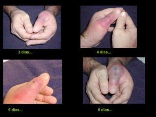 3 dias... 4 dias... 5 dias... 6 dias... 