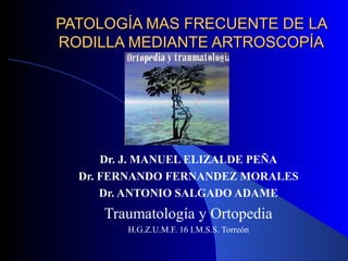 PATOLOGÍA MAS FRECUENTE DE LA
RODILLA MEDIANTE ARTROSCOPÍA

Dr. J. MANUEL ELIZALDE PEÑA
Dr. FERNANDO FERNANDEZ MORALES
Dr. ANTONIO SALGADO ADAME

Traumatología y Ortopedia
H.G.Z.U.M.F. 16 I.M.S.S. Torreón

 