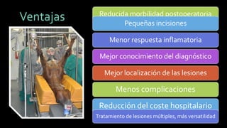 Ventajas 
Reducida morbilidad postoperatoria 
Pequeñas incisiones 
Menor respuesta inflamatoria 
Mejor conocimiento del diagnóstico 
Mejor localización de las lesiones 
Menos complicaciones 
Reducción del coste hospitalario 
Tratamiento de lesiones múltiples, más versatilidad  