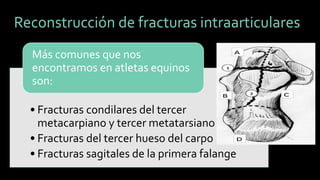 Reconstrucción de fracturas intraarticulares 
•Fracturas condilaresdel tercer metacarpiano y tercer metatarsiano 
•Fracturas del tercer hueso del carpo 
•Fracturas sagitales de la primera falange 
Más comunes que nos encontramos en atletas equinos son: 