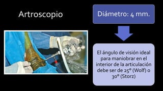 Diámetro: 4 mm. 
El ángulo de visión ideal para maniobrar en el interior de la articulación debe ser de 25°(Wolf) o 30°(Storz)  