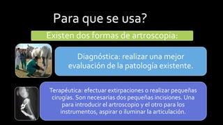 Para que se usa? 
Existen dos formas de artroscopia: 
Diagnóstica: realizar una mejor evaluación de la patología existente. 
Terapéutica: efectuar extirpaciones o realizar pequeñas cirugías. Son necesarias dos pequeñas incisiones. Una para introducir elartroscopioy el otro para los instrumentos, aspirar o iluminar la articulación.  